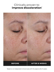 25% Vitamin C + Glutathione Clinical Serum